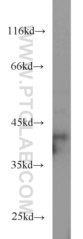 WB analysis of HepG2 using 66025-1-Ig