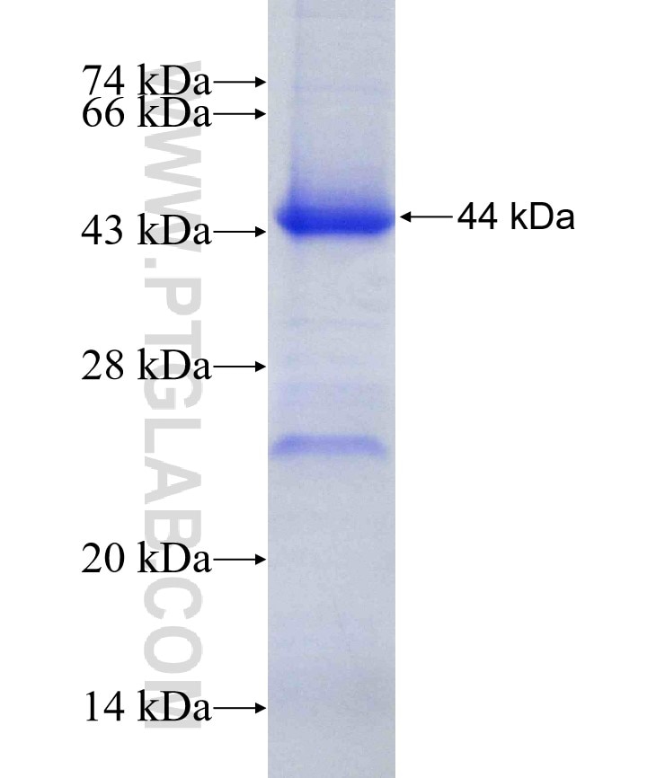 EIF3M fusion protein Ag17965 SDS-PAGE