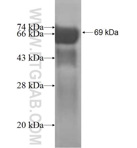 EIF3M fusion protein Ag1994 SDS-PAGE