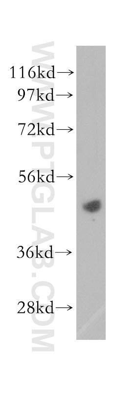 Western Blot (WB) analysis of Jurkat cells using EIF4A2 Polyclonal antibody (11280-1-AP)