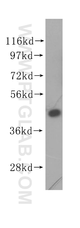 Western Blot (WB) analysis of Jurkat cells using EIF4A2 Polyclonal antibody (11280-1-AP)