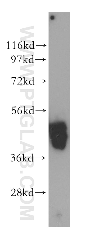 Western Blot (WB) analysis of Raji cells using EIF4A2 Polyclonal antibody (11280-1-AP)