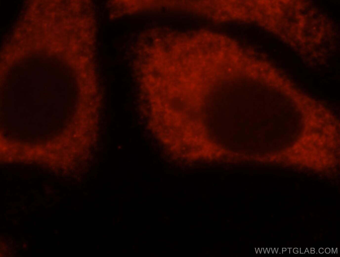 IF Staining of HepG2 using 16119-1-AP