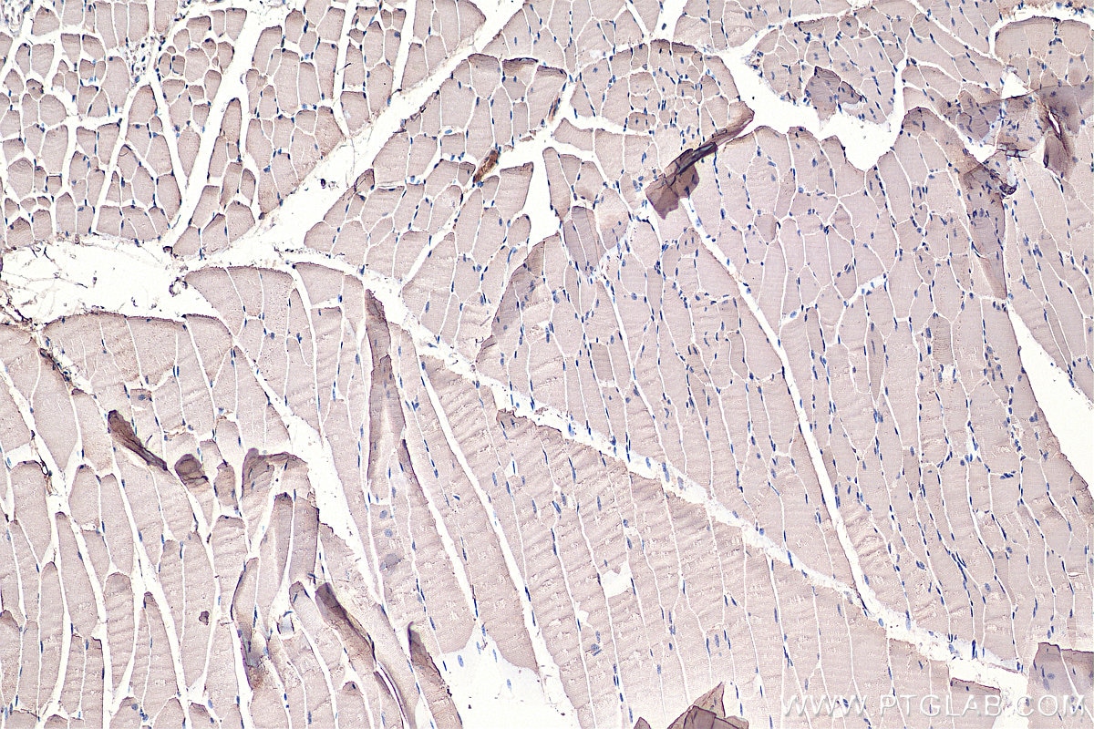 Immunohistochemistry (IHC) staining of mouse skeletal muscle tissue using EIF4A2 Polyclonal antibody (16119-1-AP)