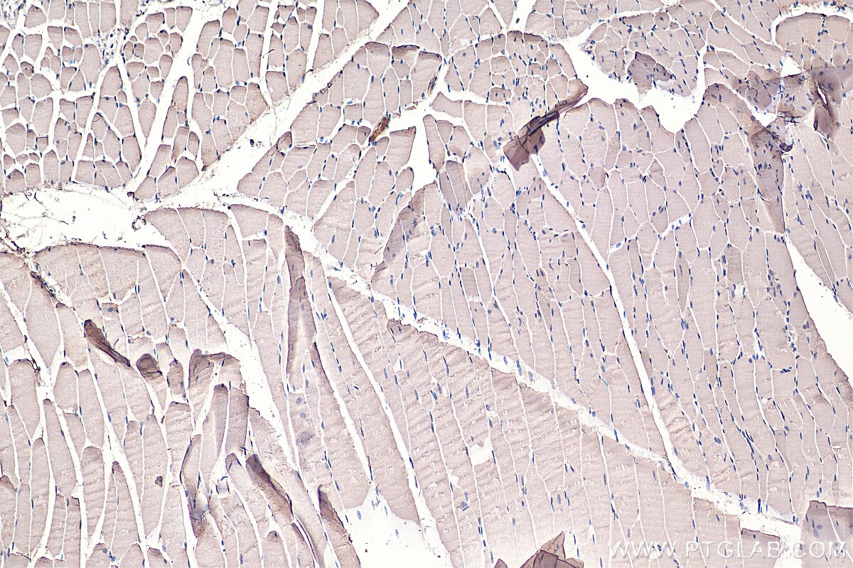 IHC staining of mouse skeletal muscle using 16119-1-AP