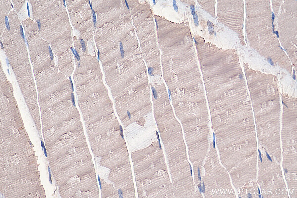 Immunohistochemistry (IHC) staining of mouse skeletal muscle tissue using EIF4A2 Polyclonal antibody (16119-1-AP)