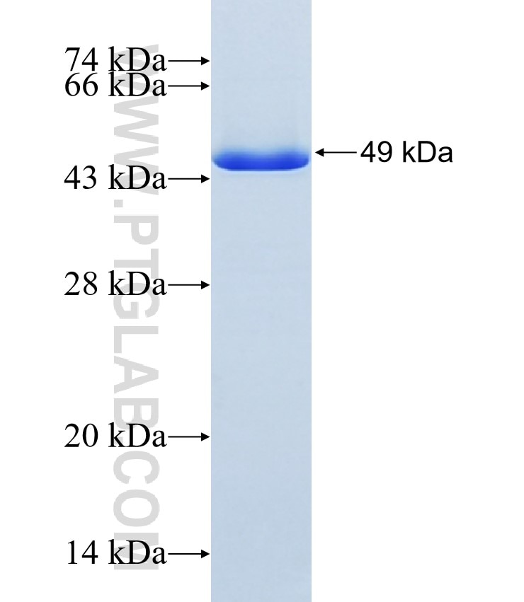 EIF4A2 fusion protein Ag9085 SDS-PAGE