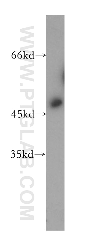 Western Blot (WB) analysis of human lung tissue using EIF4A3 Polyclonal antibody (10463-1-AP)