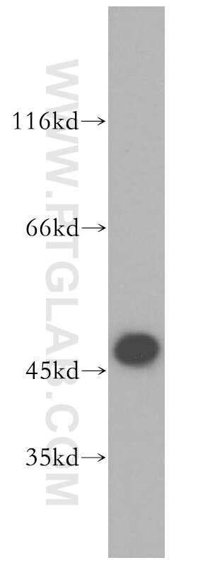 Western Blot (WB) analysis of Raji cells using EIF4A3 Polyclonal antibody (10463-1-AP)