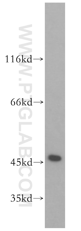 WB analysis of HeLa using 10463-1-AP