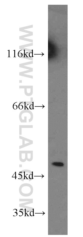 Western Blot (WB) analysis of mouse liver tissue using EIF4A3 Polyclonal antibody (10463-1-AP)