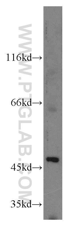 Western Blot (WB) analysis of HeLa cells using EIF4A3 Polyclonal antibody (10463-1-AP)