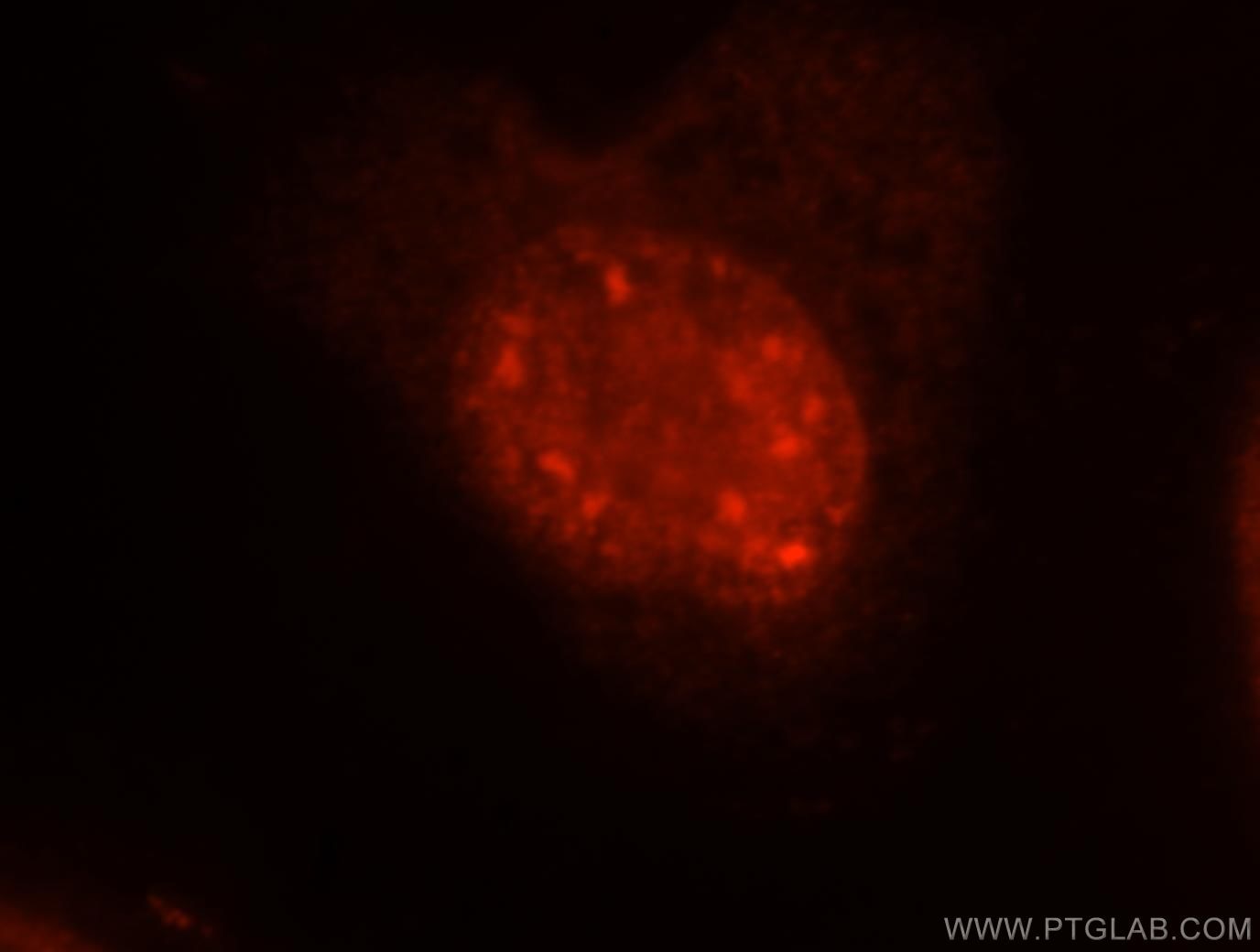 Immunofluorescence (IF) / fluorescent staining of MCF-7 cells using EIF4A3 Polyclonal antibody (17504-1-AP)