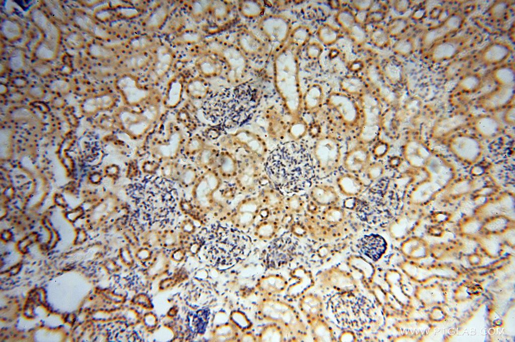 Immunohistochemistry (IHC) staining of human kidney tissue using EIF4A3 Polyclonal antibody (17504-1-AP)