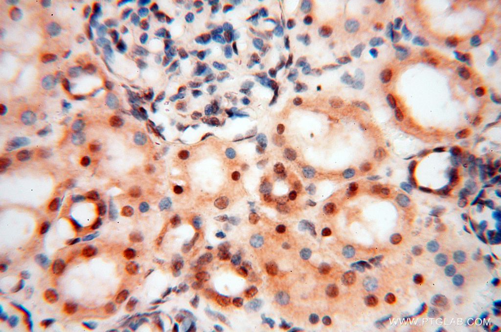 Immunohistochemistry (IHC) staining of human kidney tissue using EIF4A3 Polyclonal antibody (17504-1-AP)