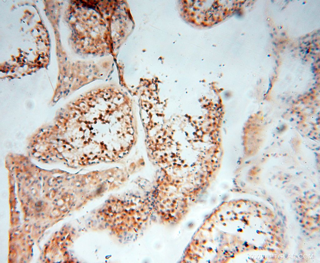 Immunohistochemistry (IHC) staining of human testis tissue using EIF4A3 Polyclonal antibody (17504-1-AP)