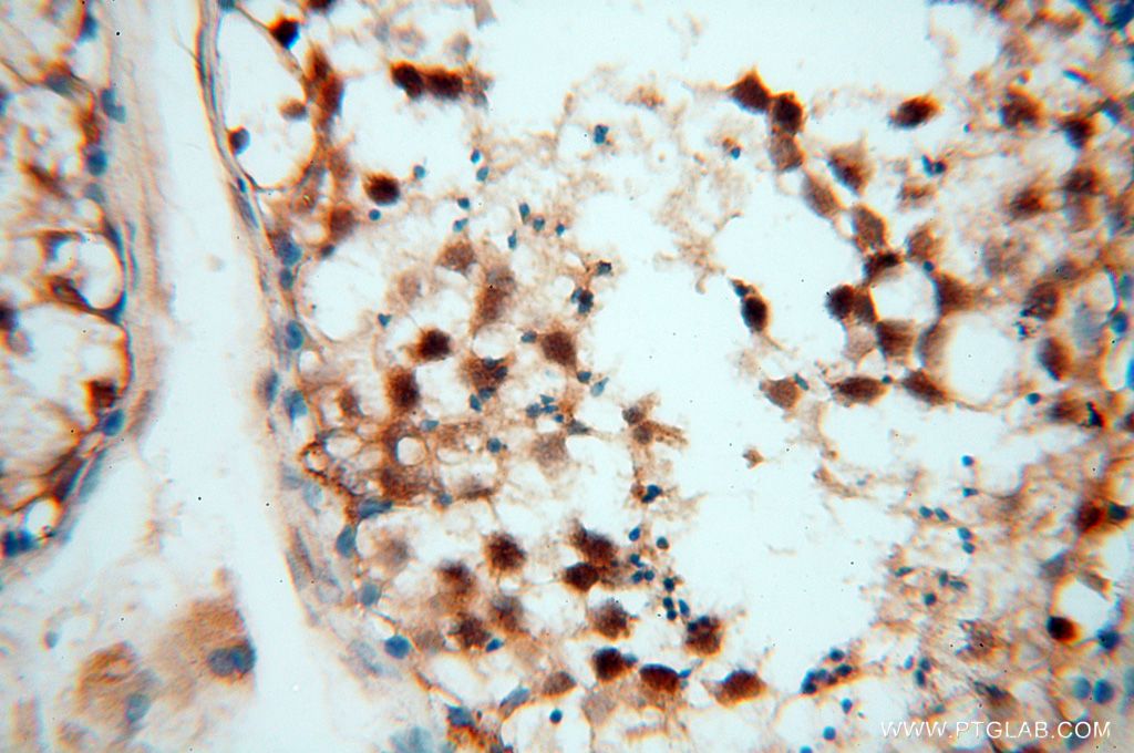 Immunohistochemistry (IHC) staining of human testis tissue using EIF4A3 Polyclonal antibody (17504-1-AP)