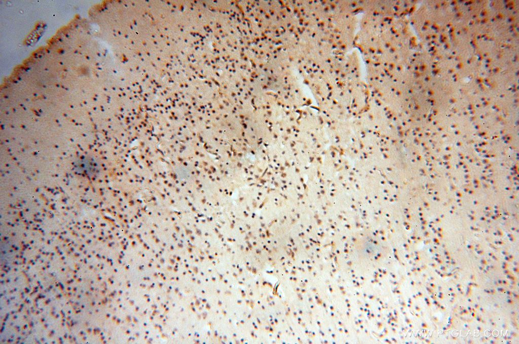 Immunohistochemistry (IHC) staining of human brain tissue using EIF4A3 Polyclonal antibody (17504-1-AP)