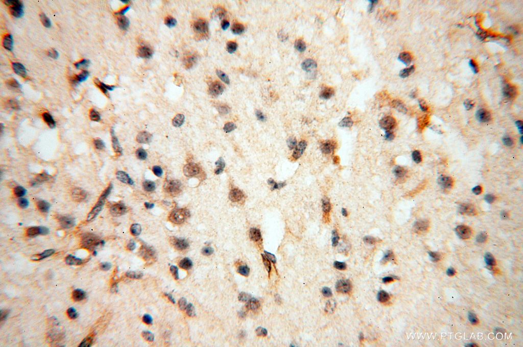 Immunohistochemistry (IHC) staining of human brain tissue using EIF4A3 Polyclonal antibody (17504-1-AP)