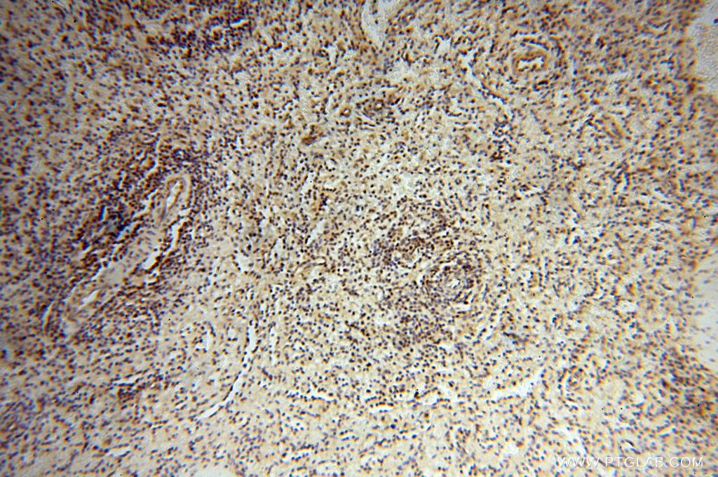 Immunohistochemistry (IHC) staining of human spleen tissue using EIF4A3 Polyclonal antibody (17504-1-AP)