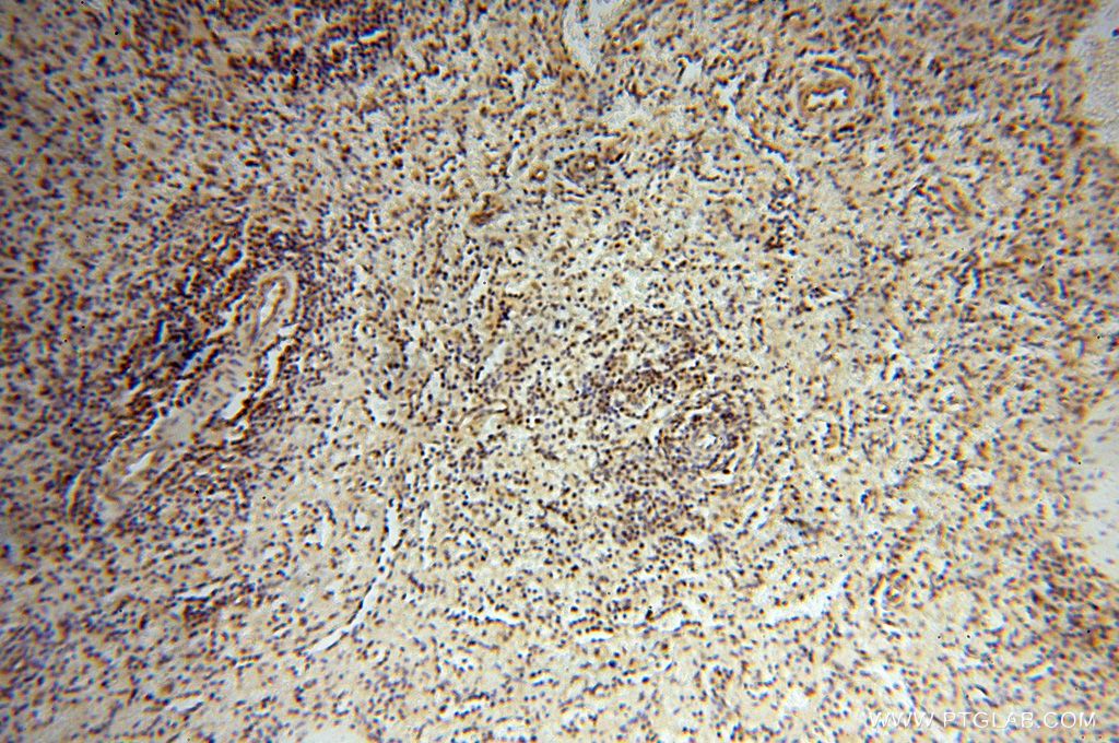 IHC staining of human spleen using 17504-1-AP