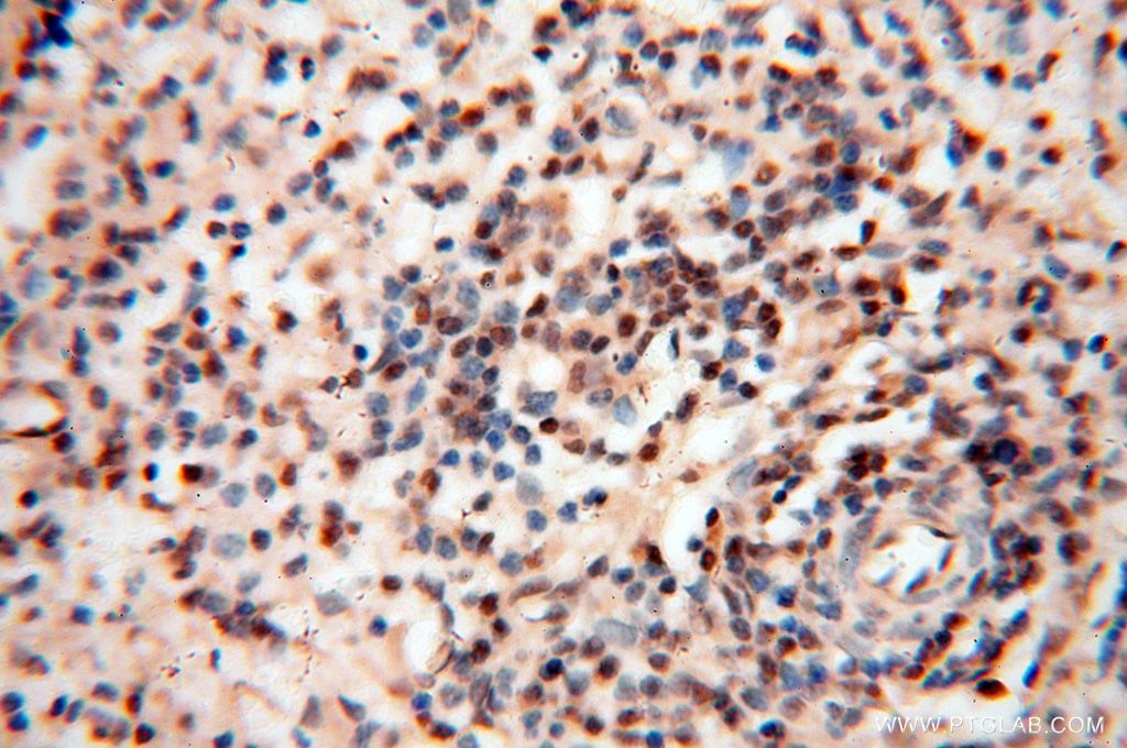 Immunohistochemistry (IHC) staining of human spleen tissue using EIF4A3 Polyclonal antibody (17504-1-AP)