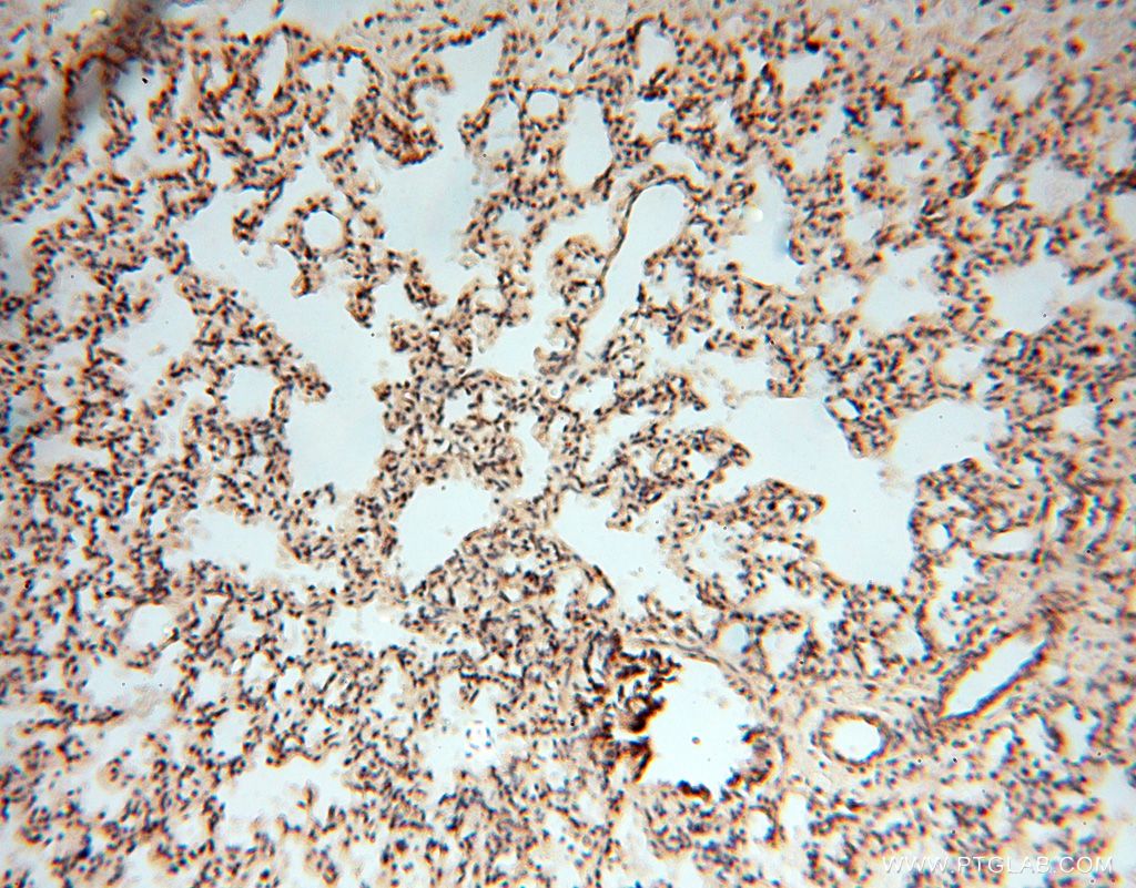 Immunohistochemistry (IHC) staining of human lung tissue using EIF4A3 Polyclonal antibody (17504-1-AP)