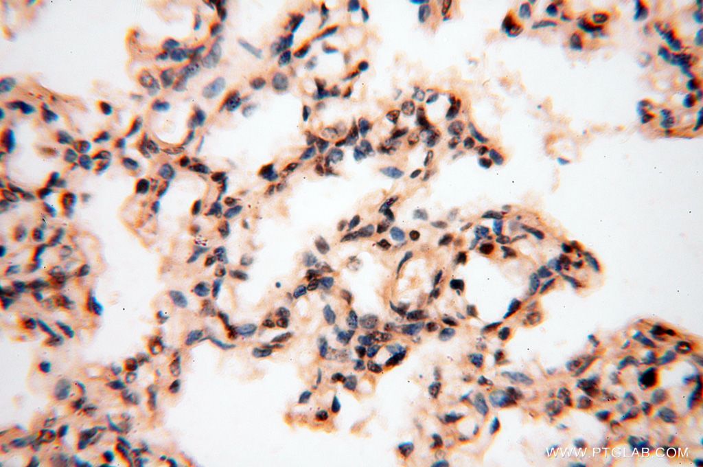 Immunohistochemistry (IHC) staining of human lung tissue using EIF4A3 Polyclonal antibody (17504-1-AP)
