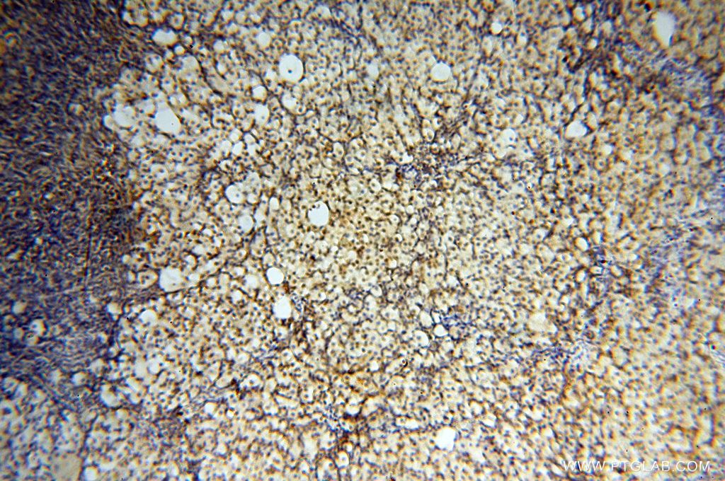 Immunohistochemistry (IHC) staining of human ovary tissue using EIF4A3 Polyclonal antibody (17504-1-AP)