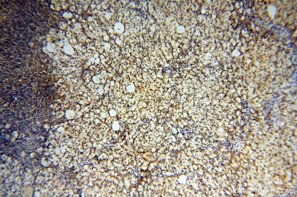 Immunohistochemistry (IHC) staining of human ovary tissue using EIF4A3 Polyclonal antibody (17504-1-AP)