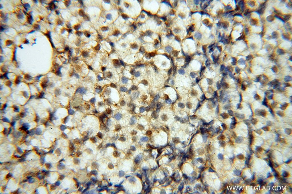 Immunohistochemistry (IHC) staining of human ovary tissue using EIF4A3 Polyclonal antibody (17504-1-AP)