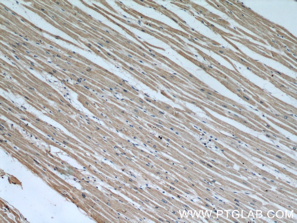 Immunohistochemistry (IHC) staining of human heart tissue using EIF4A3 Polyclonal antibody (17504-1-AP)