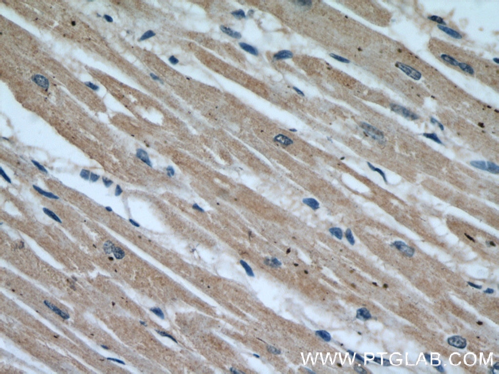 IHC staining of human heart using 17504-1-AP