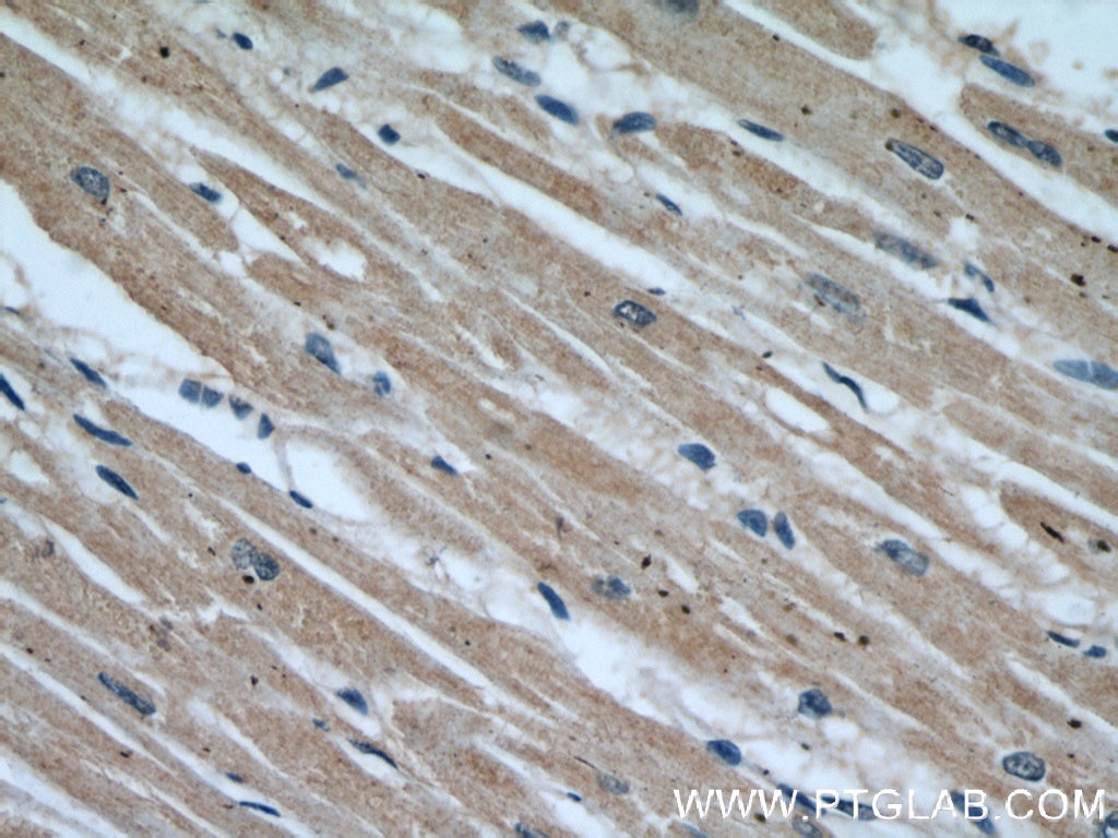 Immunohistochemistry (IHC) staining of human heart tissue using EIF4A3 Polyclonal antibody (17504-1-AP)