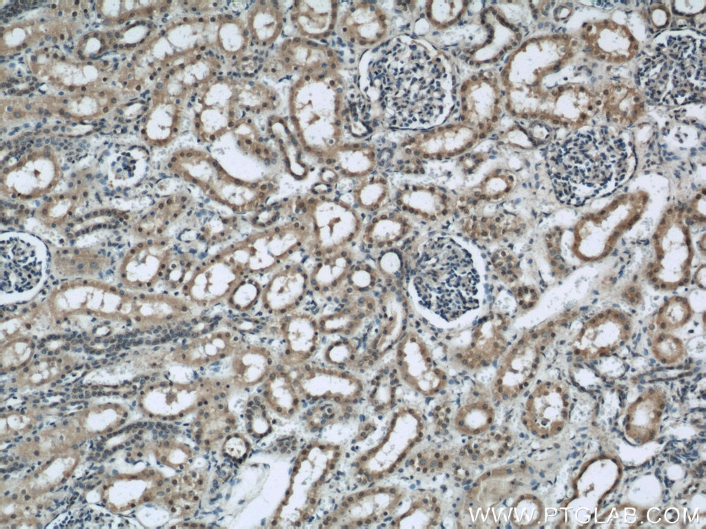 Immunohistochemistry (IHC) staining of human kidney tissue using EIF4A3 Polyclonal antibody (17504-1-AP)