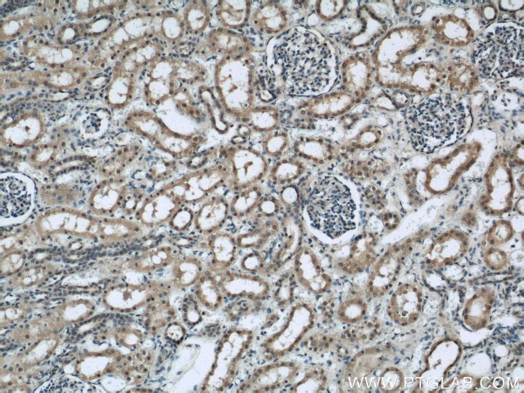 IHC staining of human kidney using 17504-1-AP