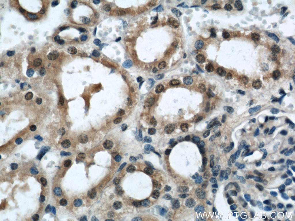 IHC staining of human kidney using 17504-1-AP