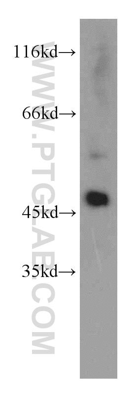 Western Blot (WB) analysis of mouse thymus tissue using EIF4A3 Polyclonal antibody (17504-1-AP)