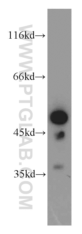 Western Blot (WB) analysis of A549 cells using EIF4A3 Polyclonal antibody (17504-1-AP)