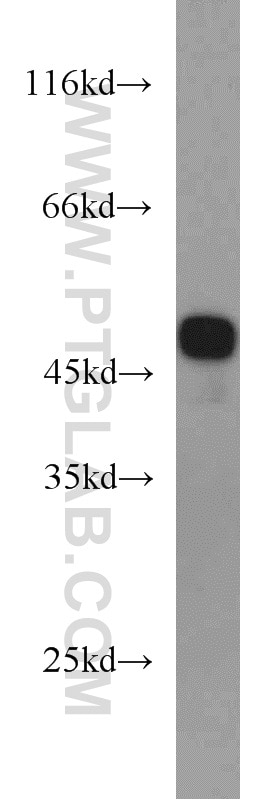 Western Blot (WB) analysis of mouse heart tissue using EIF4A3 Polyclonal antibody (17504-1-AP)