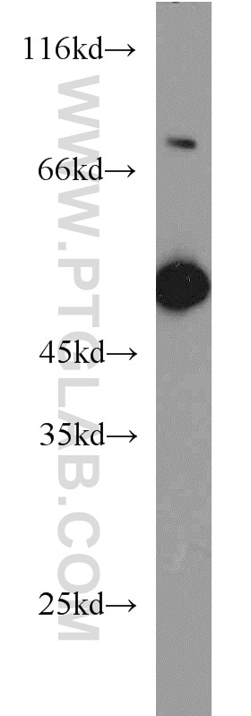 Western Blot (WB) analysis of mouse lung tissue using EIF4A3 Polyclonal antibody (17504-1-AP)