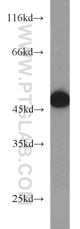 Western Blot (WB) analysis of HEK-293 cells using EIF4A3 Polyclonal antibody (17504-1-AP)