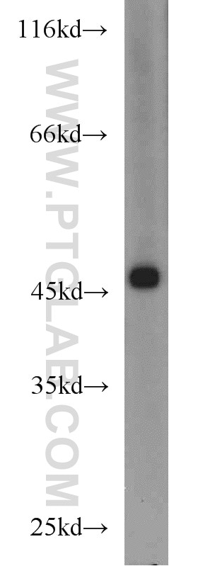 WB analysis of mouse liver using 17504-1-AP