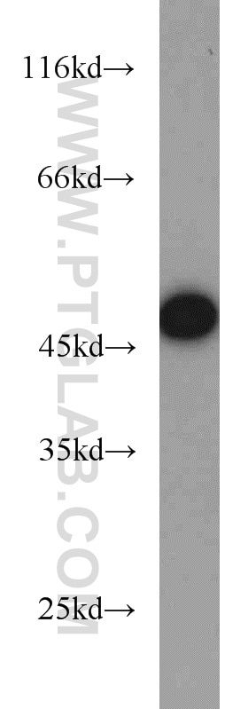 Western Blot (WB) analysis of HeLa cells using EIF4A3 Polyclonal antibody (17504-1-AP)
