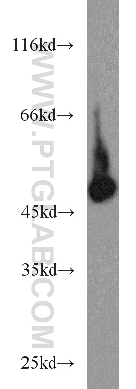 Western Blot (WB) analysis of MCF-7 cells using EIF4A3 Polyclonal antibody (17504-1-AP)