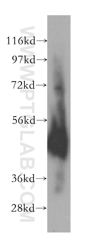 Western Blot (WB) analysis of mouse thymus tissue using EIF4A3 Polyclonal antibody (17504-1-AP)