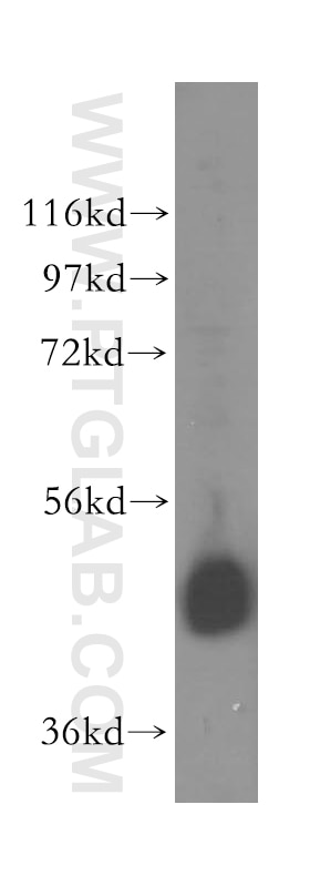 Western Blot (WB) analysis of A549 cells using EIF4A3 Polyclonal antibody (17504-1-AP)