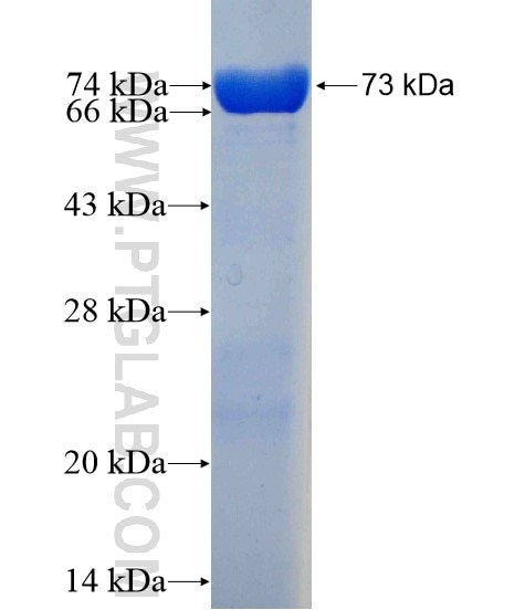 EIF4A3 fusion protein Ag11701 SDS-PAGE