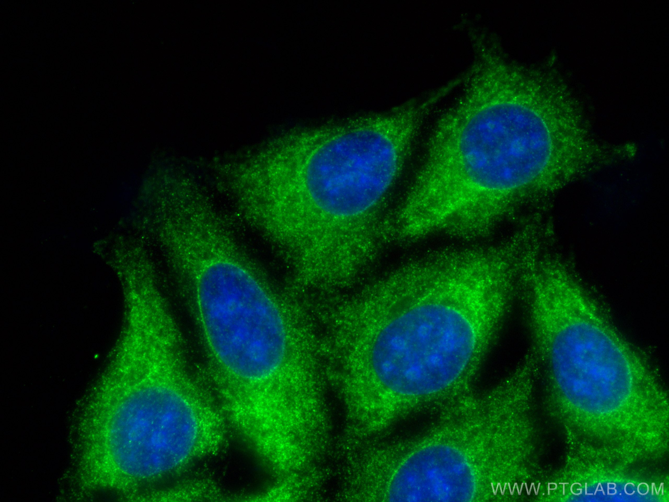 Immunofluorescence (IF) / fluorescent staining of MCF-7 cells using EIF4B Polyclonal antibody (17917-1-AP)