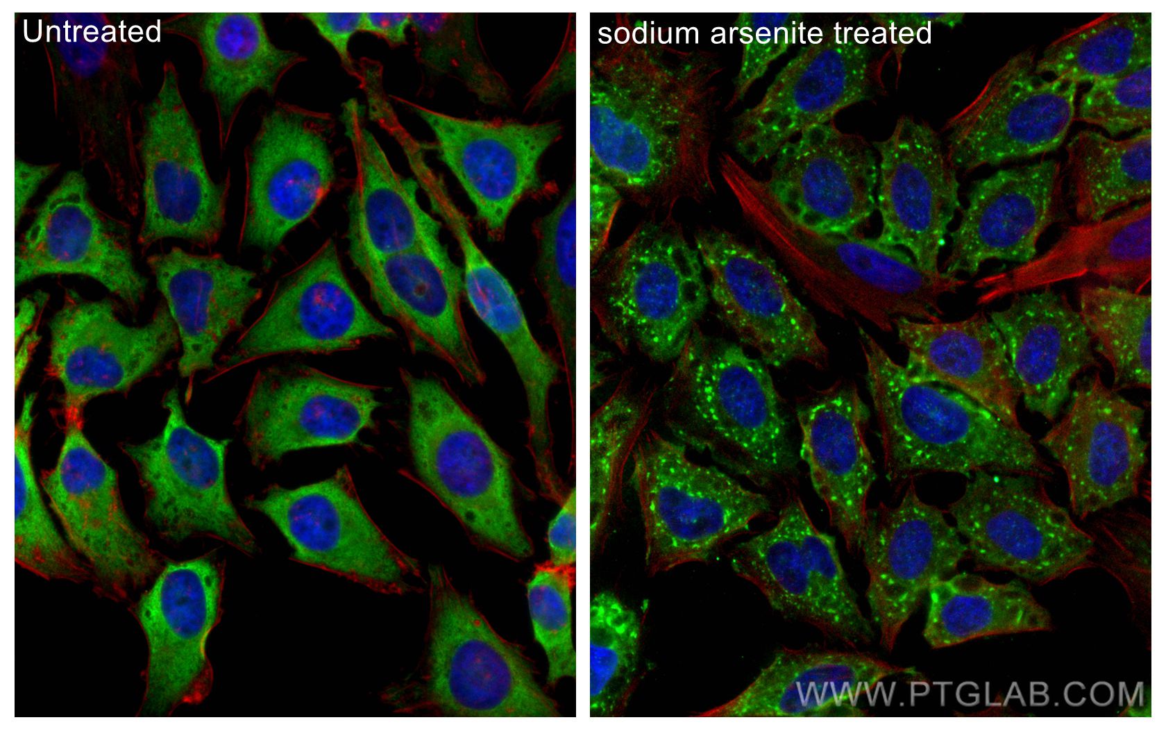 Immunofluorescence (IF) / fluorescent staining of HeLa cells using EIF4B Polyclonal antibody (17917-1-AP)